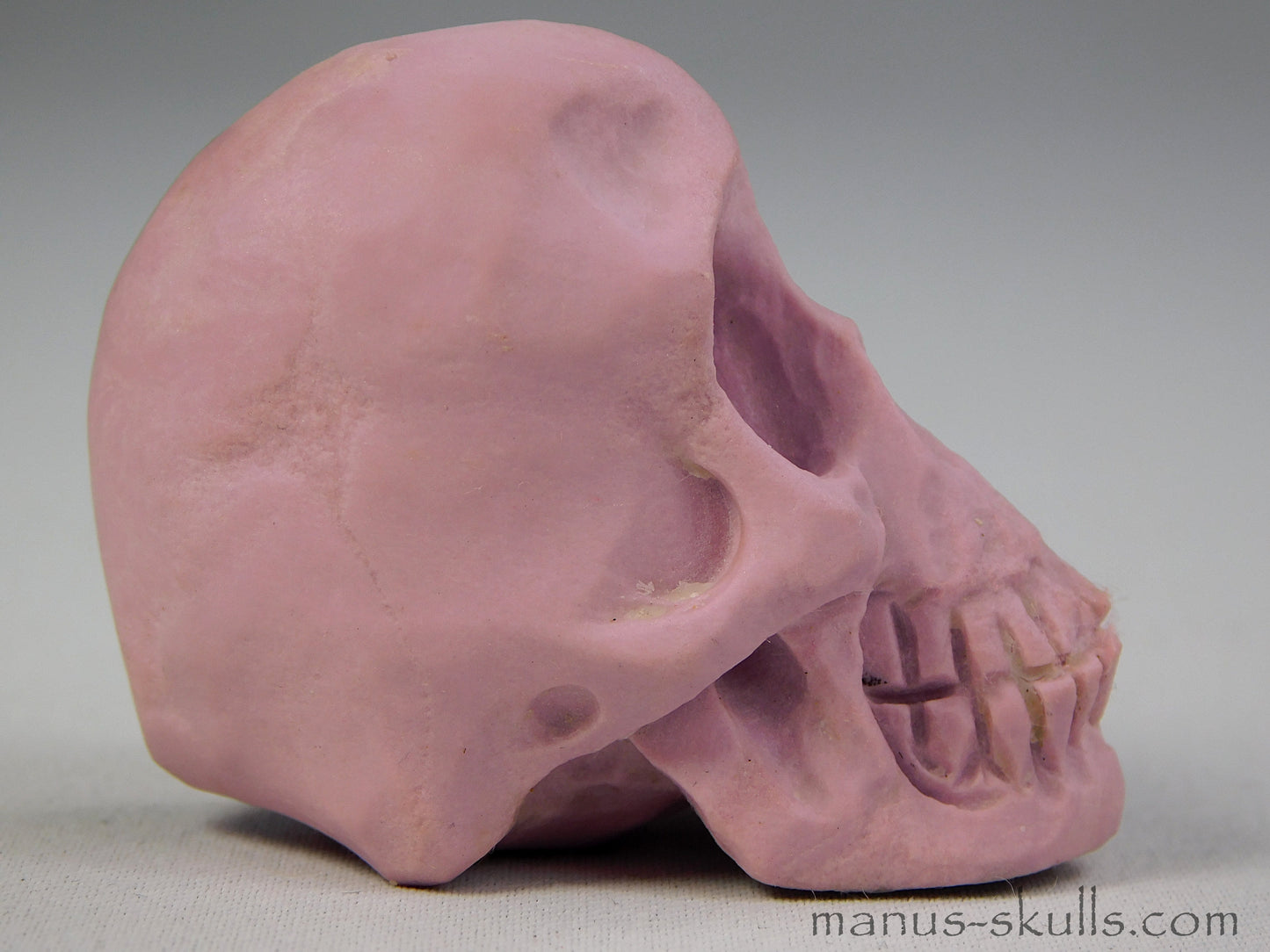 Phosphosiderite Skull